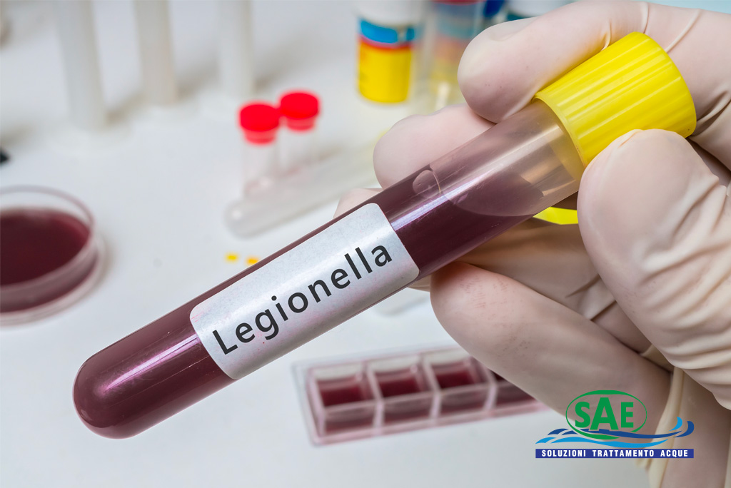 Che cos’è la Legionella e come si manifesta | SAE TECNOLOGY